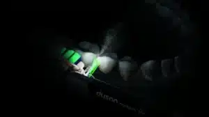 7-مسواک شارژی دایسون CameraJet